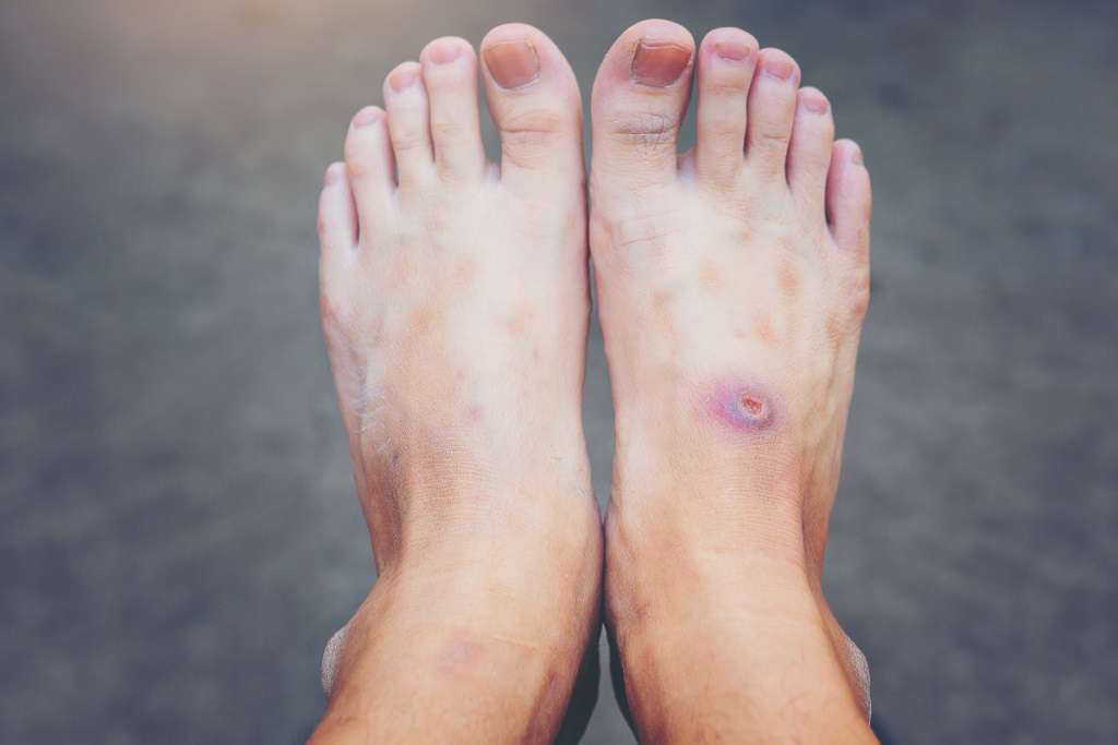تشخیص دیابت؛ انواعت تشخیص با و بدون آزمایش و علائم هشدار دهنده