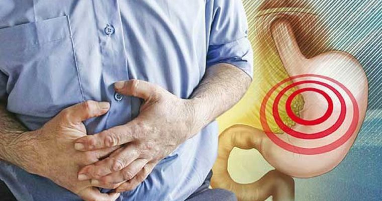 سوزش معده؛ علایم، دلایل و درمان سوزه معده