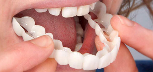 لمینت متحرک چیست و چطور استفاده می شود؟ معایب و عوارض استفاده از آن