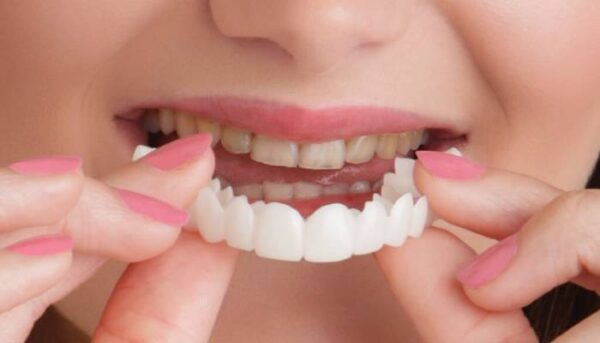 لمینت متحرک چیست و چطور استفاده می شود؟ معایب و عوارض استفاده از آن
