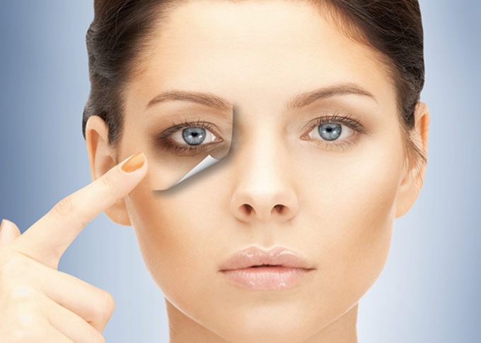 سیاهی دور چشم؛ علل سیاهی دور چشم، درمان های مختلف برای رفع سیاهی دور چشم