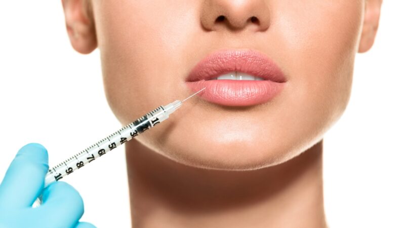 اطلاعات کامل درباره تزریق ژل لب، مزایای آن، مراقبت ها و روش های انجام