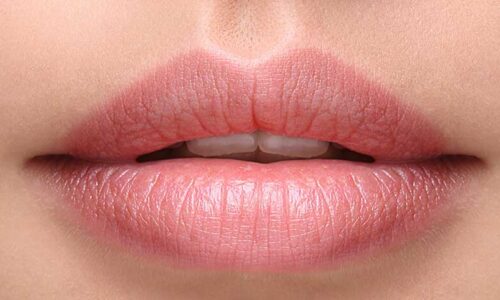 اطلاعات کامل درباره تزریق ژل لب، مزایای آن، مراقبت ها و روش های انجام
