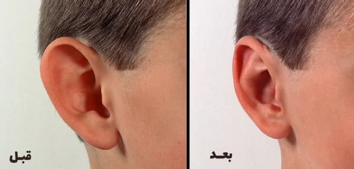 انواع عمل زیبایی صورت و بدن؛ نحوه انجام و نکاتی که باید بدانید
