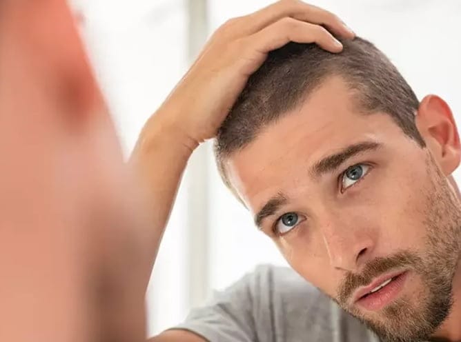 کاشت مو با الیاف؛ روش انجام این نوع کاشت مو و مزایای آن