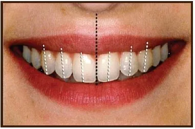 میدلاین دندان چیست؟ روش درمان و انواع میدلاین