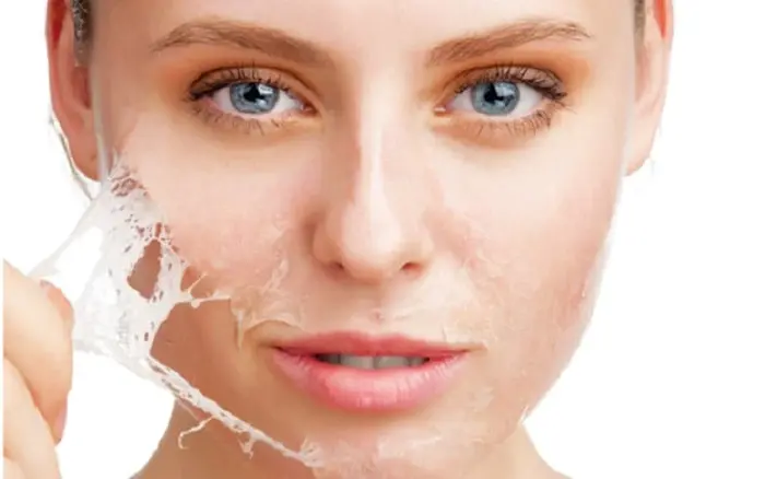 پیشگیری از چروک لب؛ دلایل ایجاد، انواع چروک لب، درمان خانگی و روش های پزشکی