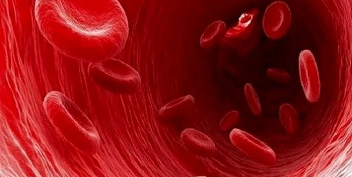علائم غلظت خون؛ عوارض این بیماری خونی و درمان آن