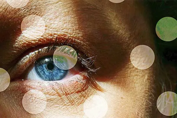 مگس پرانی چشم چیست؟ دلایل ایجاد نقاط متحرک در چشم و روش های درمان
