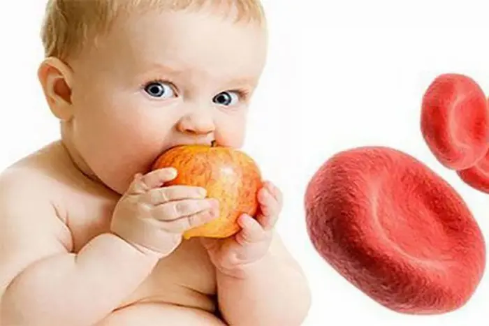کم خونی داسی شکل کودک؛ علائم و روش های درمان این نوع کم خونی