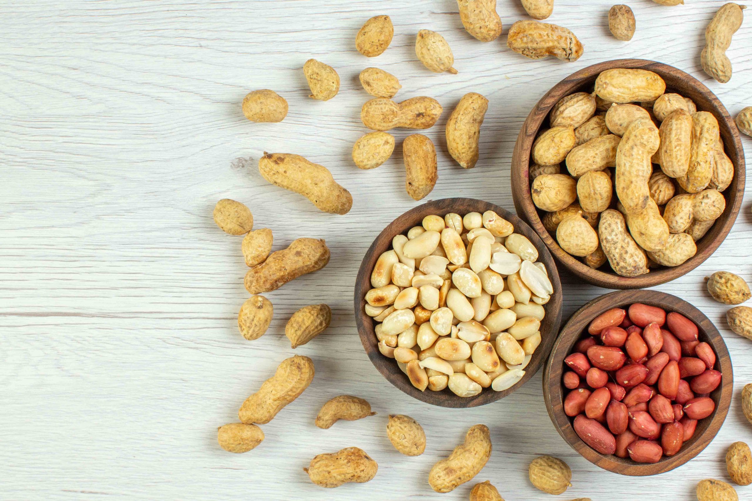 فواید بادام زمینی برای خانم ها (10 خاصیت از کمک به کاهش وزن تا افزایش انرژی) فواید بادام زمینی برای خانم ها (10 خاصیت از کمک به کاهش وزن تا افزایش انرژی)