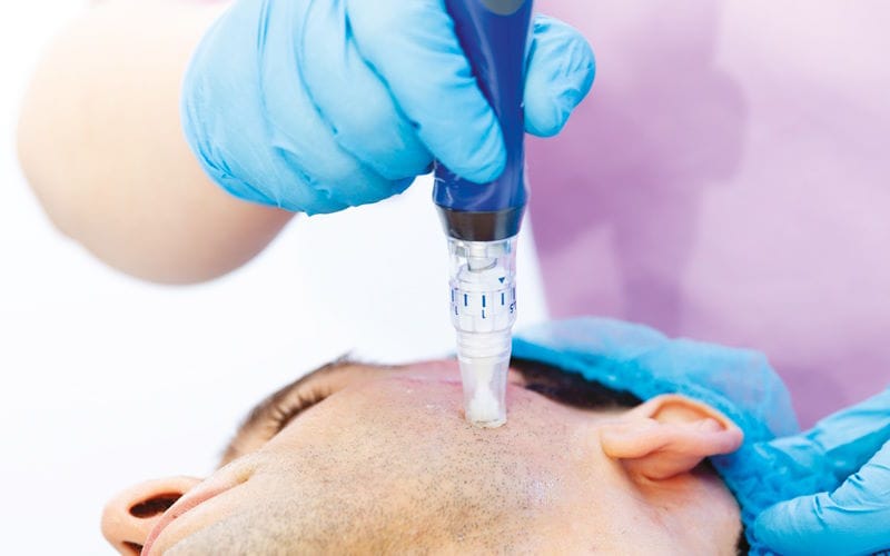 اسید تراپی چیست؟ انواع اسید تراپی برای زیبایی و سلامت پوست