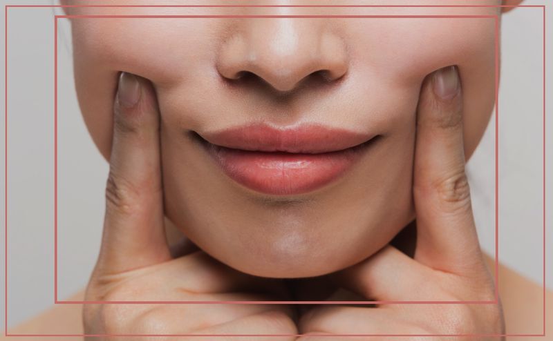 تزریق ژل خط خنده (عوارض، ماندگاری، قیمت و عکس های قبل و بعد انجام آن)