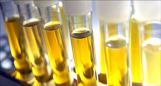 تعبیر خواب ادرار ابن سیرین معنی ادرار در خواب های ما از نظر ابن سیرین چیست
