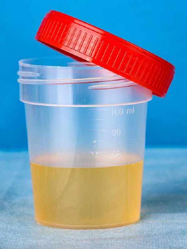 تعبیر خواب ادرار مرده از نظر حضرت یوسف + معنی ادرار مرده از نظر حضرت یوسف چیست تعبیر خواب ادرار مرده از نظر حضرت یوسف + معنی ادرار مرده از نظر حضرت یوسف چیست