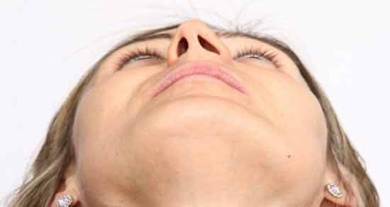 تعبیر خواب بینی کج شده معنی بینی کج شده در خواب های ما چیست