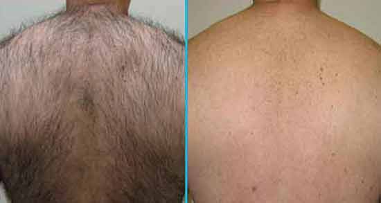 تعبیر خواب تراشیدن موی کمر معنی تراشیدن موی کمر در خواب های ما چیست