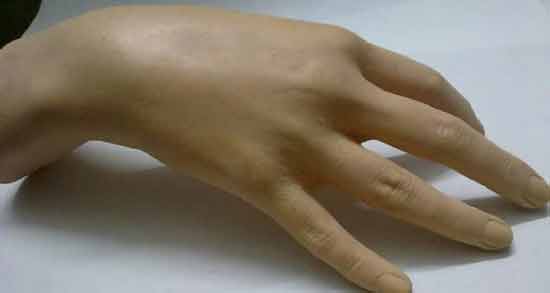 تعبیر خواب دست چلاق معنی دست چلاق در خواب های ما چیست