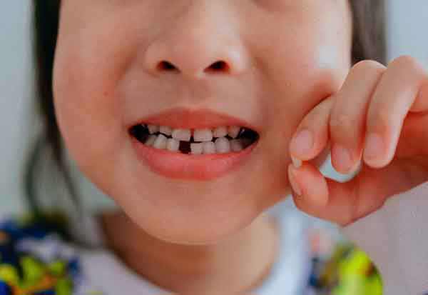 تعبیر خواب دندان افتادن فک بالا + معنی دندان افتادن فک بالا از نظر امام صادق چیست تعبیر خواب دندان افتادن فک بالا + معنی دندان افتادن فک بالا از نظر امام صادق چیست