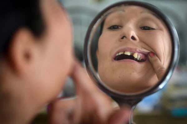 تعبیر خواب دندان خراب امام صادق + معنی دندان خراب از نظر امام صادق چیست