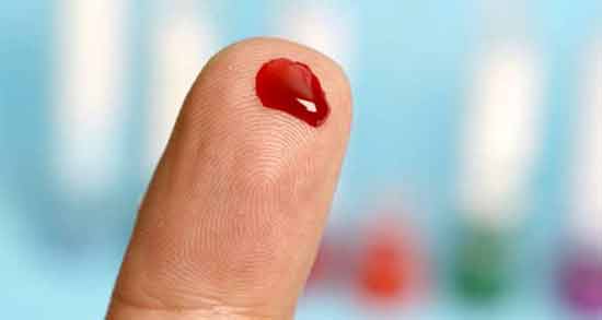تعبیر خواب زخم انگشت معنی زخم انگشت در خواب های ما چیست