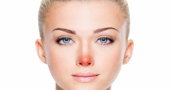 تعبیر خواب زخم روی بینی معنی زخم روی بینی در خواب های ما چیست