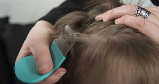 تعبیر خواب شپش برای زن باردار نی نی سایت معنی شپش در خواب چیست