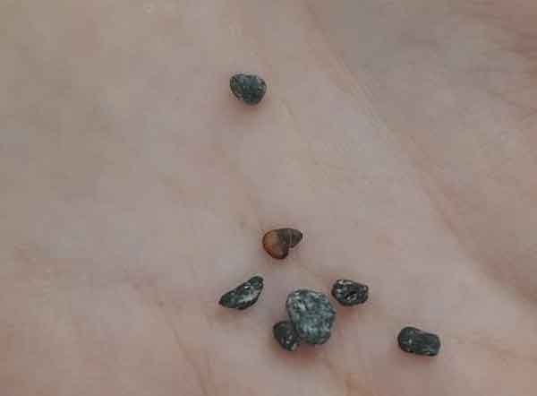 تعبیر خواب فضله موش روی فرش خانه و باغ از نظر امام صادق و ابن سیرین