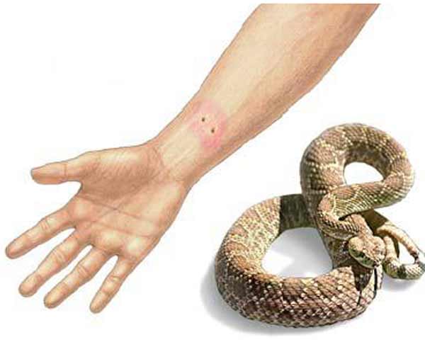 تعبیر خواب مار گازت بگیره + معنی مار گازت بگیره در خواب چیست
