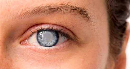 تعبیر خواب چشم حضرت یوسف معنی چشم در خواب های ما از نظر حضرت یوسف چیست
