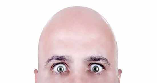 تعبیر خواب کچل شدن دیگری معنی کچل شدن دیگری در خواب های ما چیست