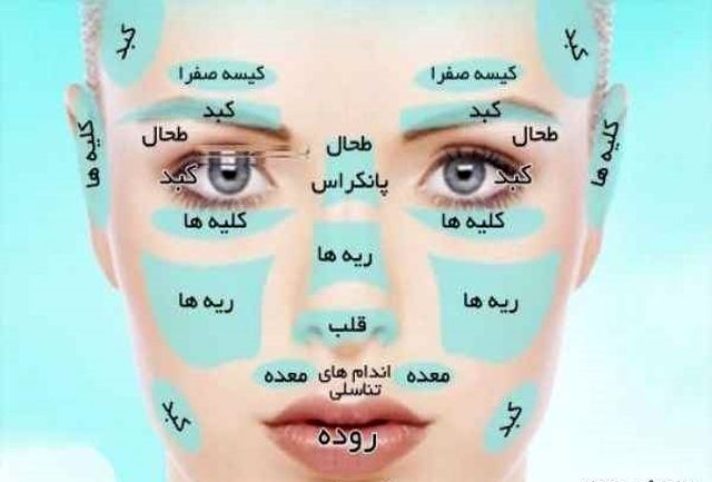 دلیل جوش زدن در نواحی مختلف صورت