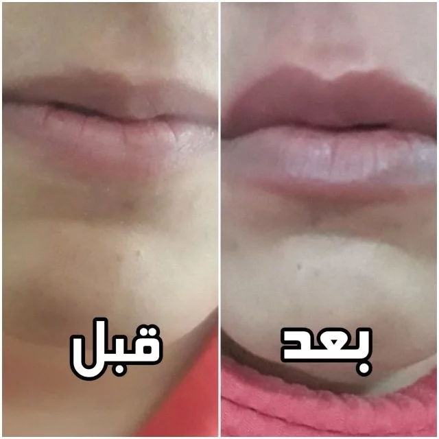 روغن خراطین