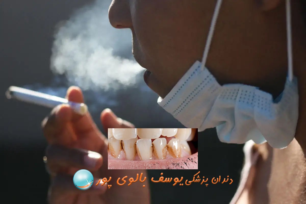 سیگاری ها از چه روش هایی برای سفیدی دندان استفاده کنند؟