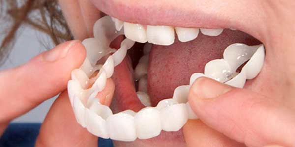 لمینت متحرک چیست و چطور استفاده می شود؟ معایب و عوارض استفاده از آن