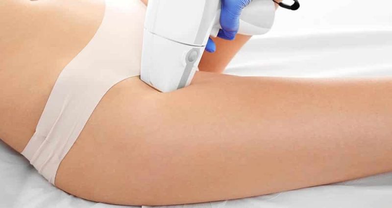 لیزر موهای زائد بیکینی (واژن) و اطلاعات در مورد عوارض و مراقبت ها