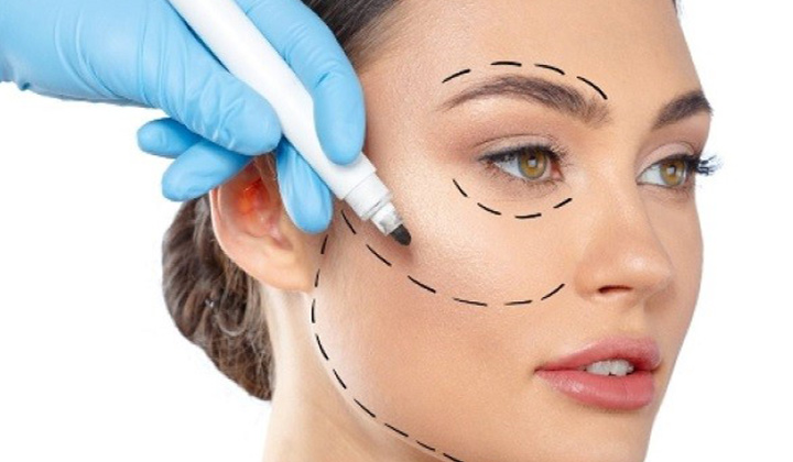پلکسر یا پلاسما تراپی ابرو برای زیبایی چهره (مزایای و معایب)