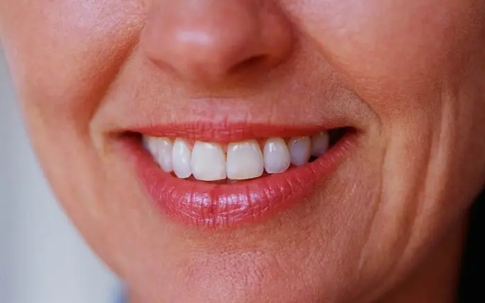 پیشگیری از چروک لب؛ دلایل ایجاد، انواع چروک لب، درمان خانگی و روش های پزشکی