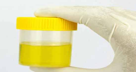 تعبیر خواب بوی ادرار ، معنی بوی ادرار در خواب های ما چیست تعبیر خواب بوی ادرار ، معنی بوی ادرار در خواب های ما چیست