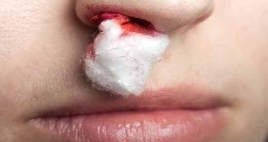 تعبیر خواب خون دماغ حضرت یوسف ، معنی خون دماغ در خواب های ما از نظر حضرت یوسف چیست