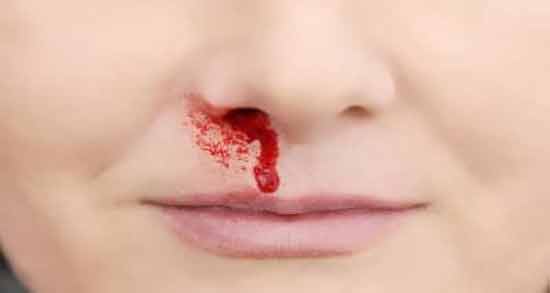 تعبیر خواب خون دماغ شدن از نظر امام صادق ، معنی خون دماغ شدن در خواب های ما از نظر امام صادق چیست