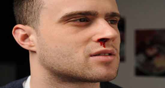 تعبیر خواب خون دماغ شدن شوهر ، معنی خون دماغ شدن شوهر در خواب های ما چیست