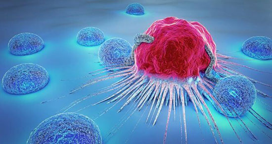 تعبیر خواب سرطان گرفتن مرده ، معنی سرطان گرفتن مرده در خواب ما چیست تعبیر خواب سرطان گرفتن مرده ، معنی سرطان گرفتن مرده در خواب ما چیست