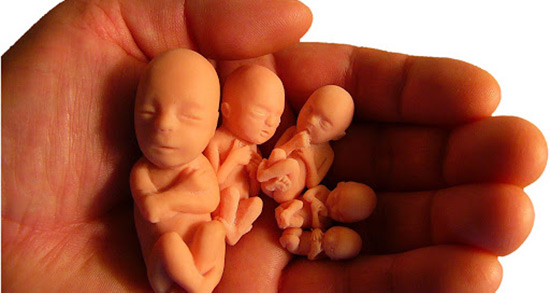 تعبیر خواب سقط جنین برای زن باردار ، معنی دیدن سقط جنین برای زن باردار