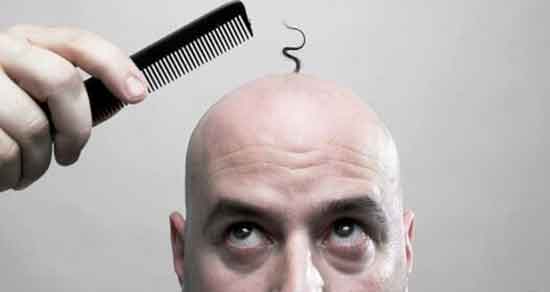 تعبیر خواب طاس شدن مو ، معنی طاس شدن مو در خواب های ما چیست