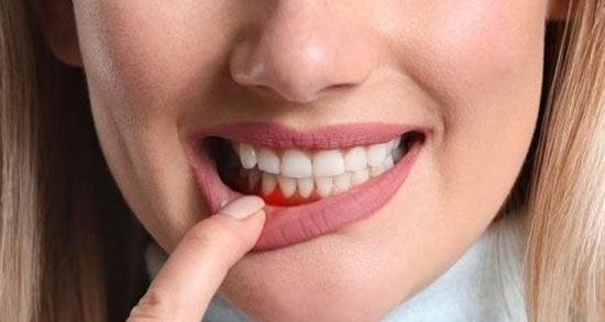 تعبیر خواب لثه ورم کرده ، معنی دیدن لثه ورم کرده در خواب های ما چیست
