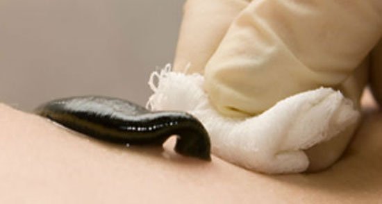 دیدن زالو در خواب تعبیر ، معنی دیدن زالو در خواب های ما چیست