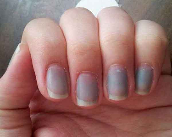 کبودی انگشتان را جدی بگیرید + سیانوز می تواند جان شما را بگیرد عکس کبودی های خطرناک علت کبود شدن بند انگشت دست عکس کبودی انگشت دست کبودی انگشتان پا و ایست قلبی علت کبودی انگشت دست کبودی انگشتان دست در بارداری کبودی بدن پلاکت خون درمان سیاه شدن انگشت دست