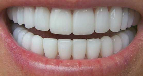 تعبیر خواب افتادن دندان پوسیده ، معنی دیدن افتادن دندان پوسیده در خواب ما چیست