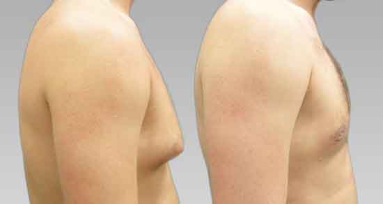 تعبیر خواب بوسیدن سینه ؛ معنی بوسیدن سینه در خواب های ما چیست